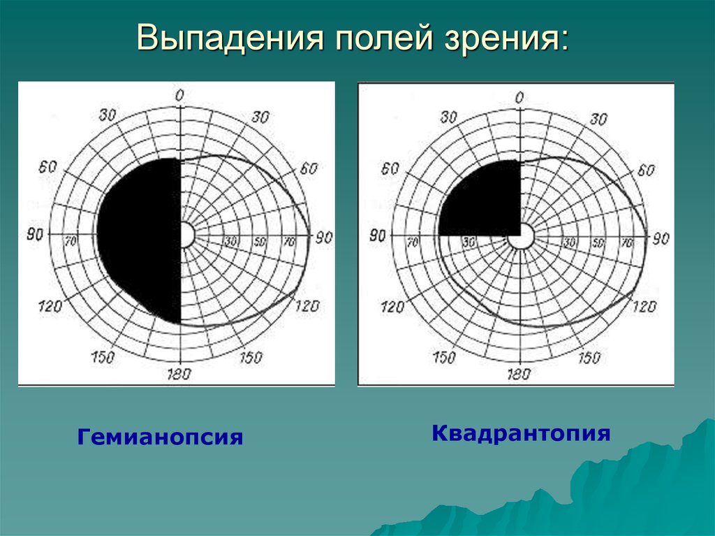 Поля зрения в норме схема