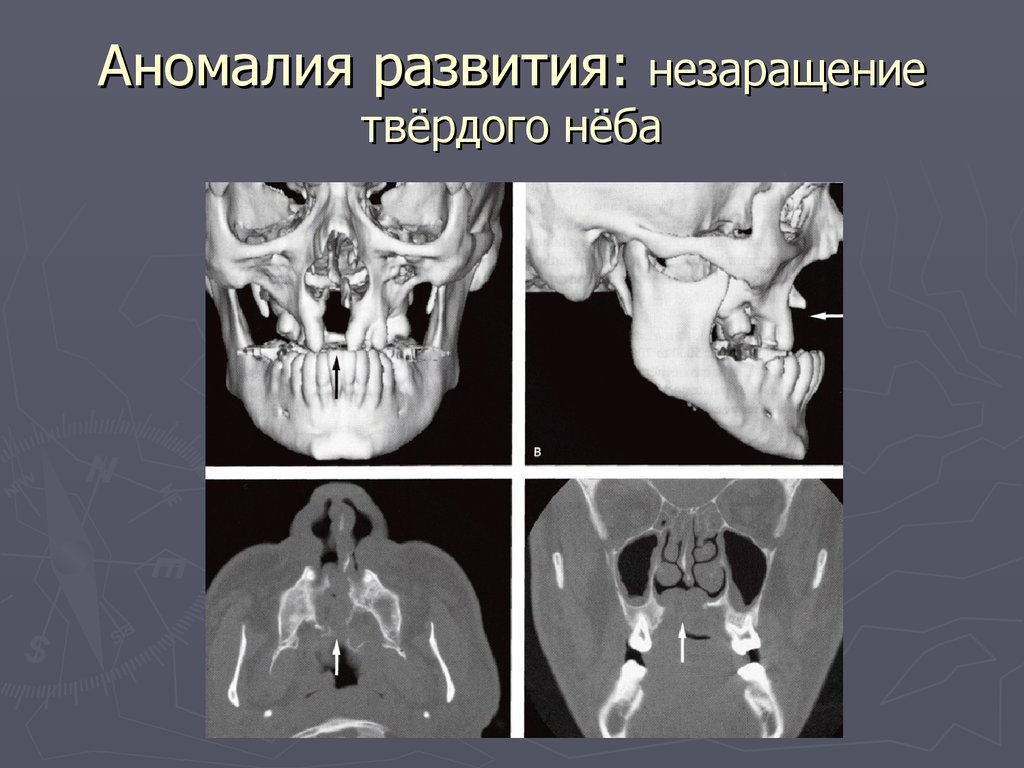 Лучевая диагностика заболеваний головы и шеи презентация