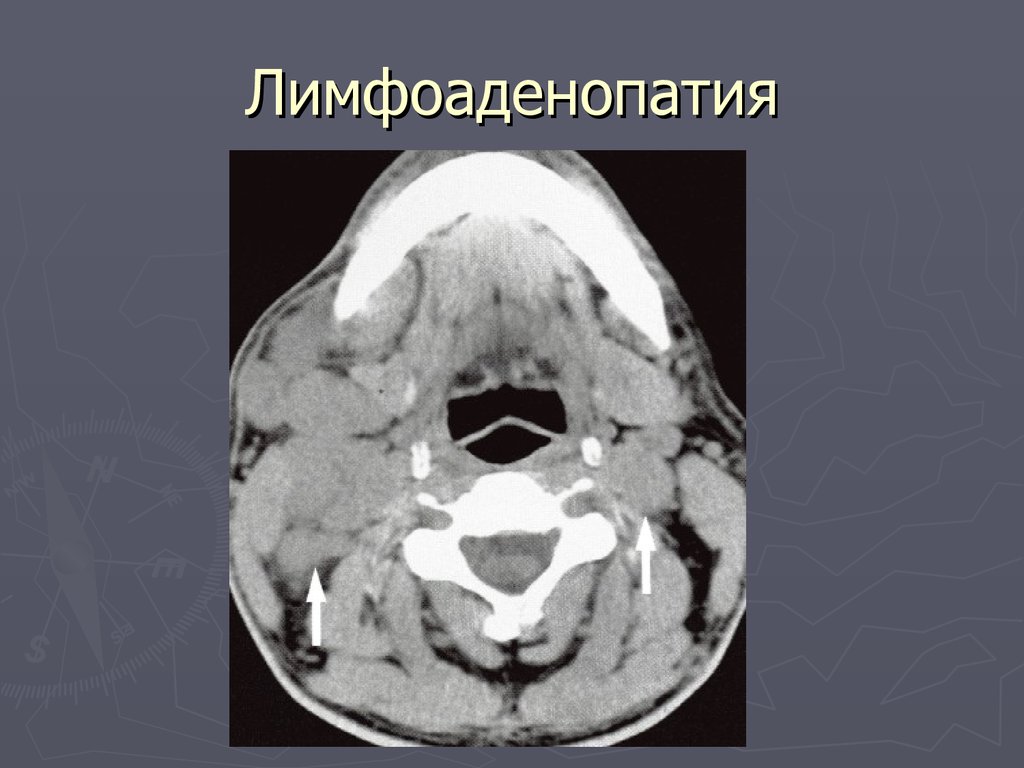 Система как компьютерная помощь в диагностике заболеваний на основе построения