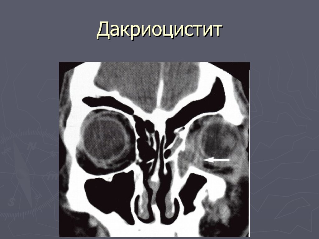 Лучевая диагностика заболеваний головы и шеи презентация