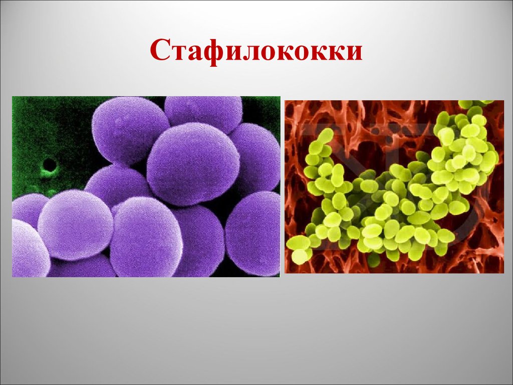 Staphylococcus aureus 5. Коагулазопозитивные стафилококки. GRSA стафилококки. Лецитиназоположительные стафилококки. Стрептококки 5 класс биология.