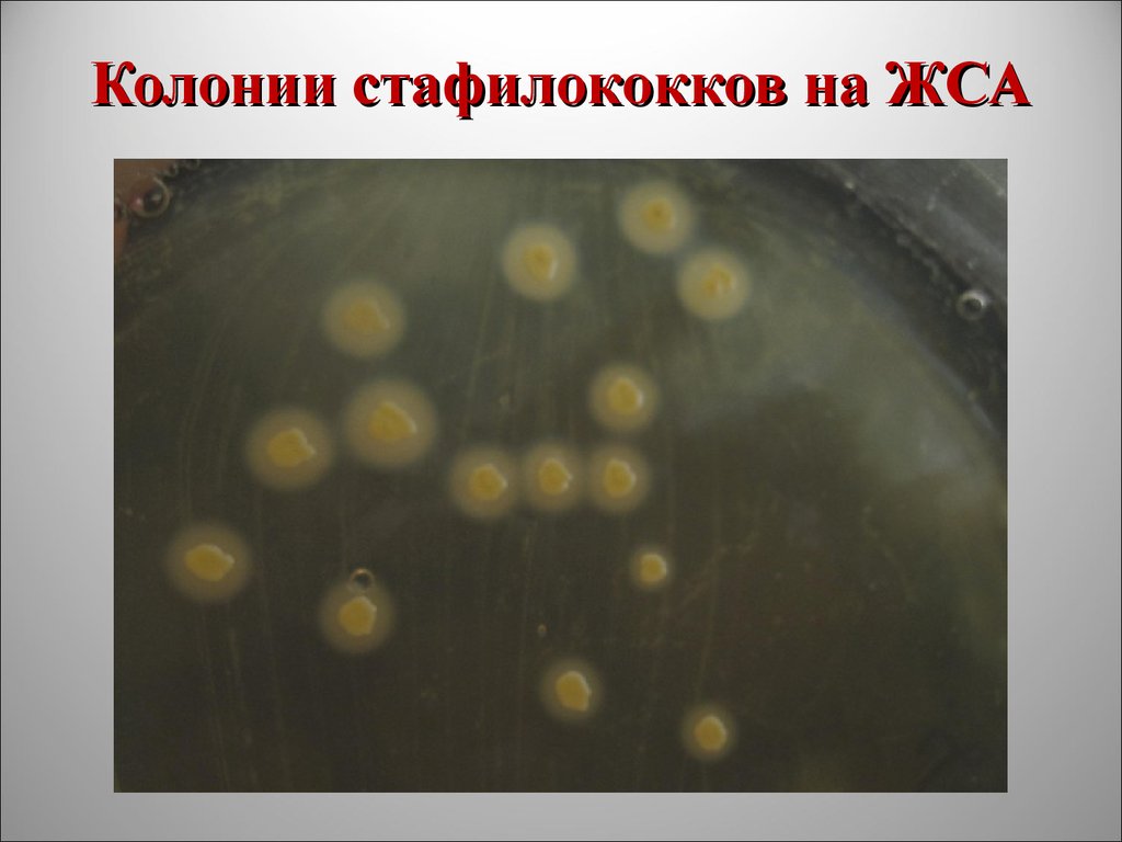 Staphylococcus aureus среда. Рост стафилококков на ЖСА. Колонии золотистого стафилококка на желточно-солевом агаре. Стаыилококки на желточном соевом агаре. Рост стафилококков на желточно-солевом агаре.