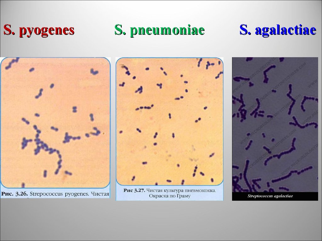 Стрептококков стафилококков. Чистая культура Streptococcus pneumoniae. Стрептококки окраска по Граму. Пиогенный стрептококк культура. Streptococcus pyogenes чистая культура.