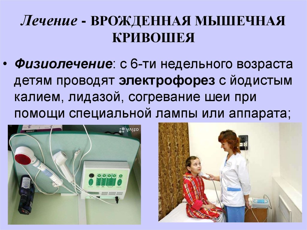 Презентация на тему кривошея