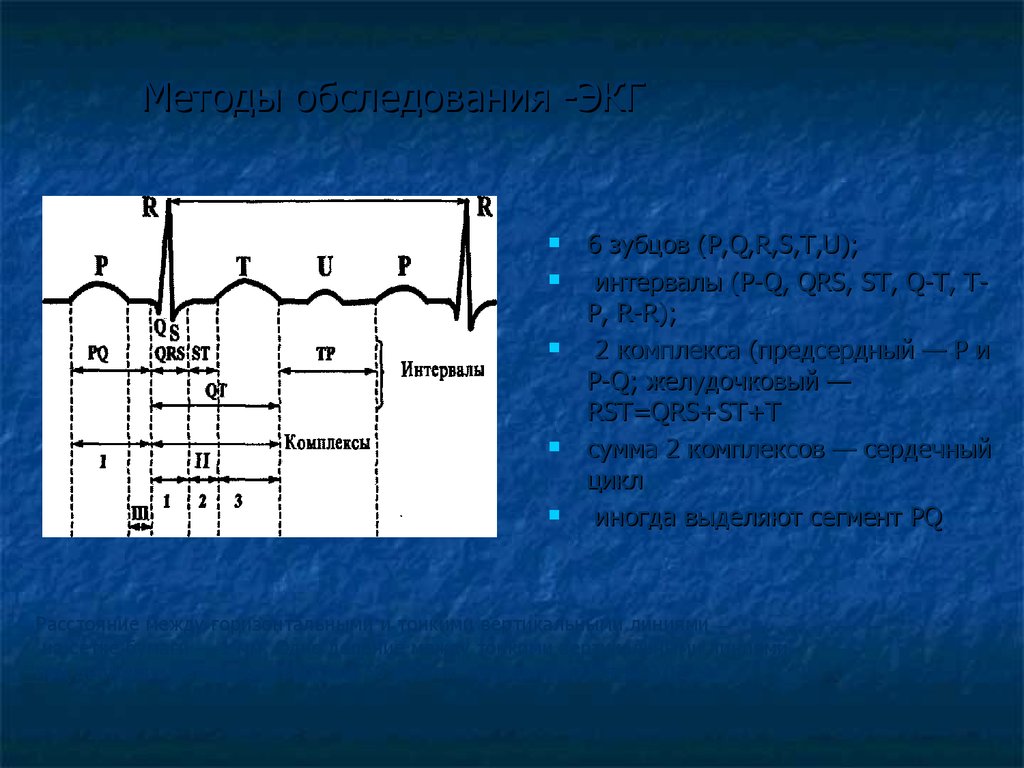 Интервал QRS. Интервал PQ. Система QRS. ЭКГ 6.