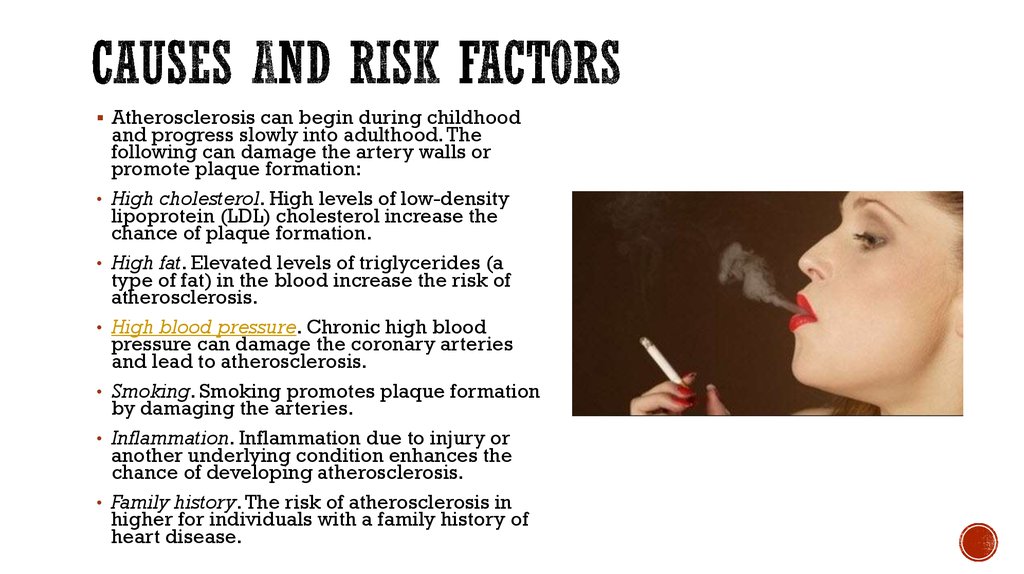 Causes and Risk factors