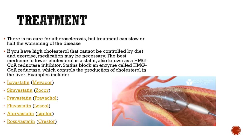 What Is Atherosclerosis Diagnosis Treatment And Preve - vrogue.co