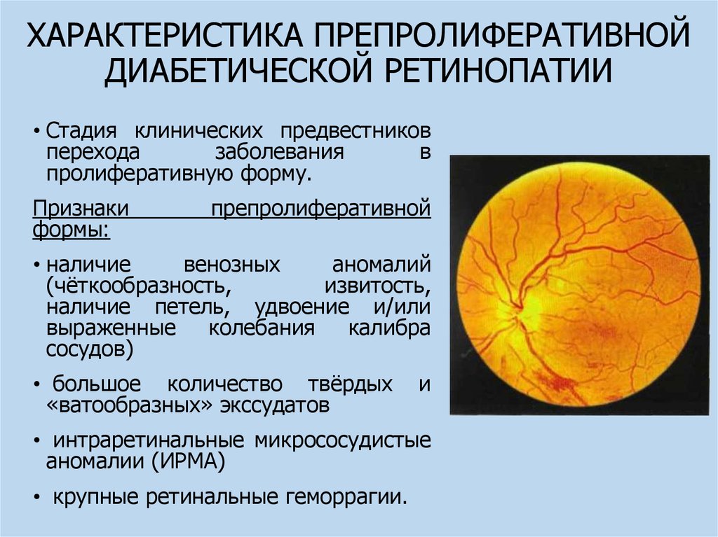 Диабетическая ретинопатия презентация офтальмология - 83 фото