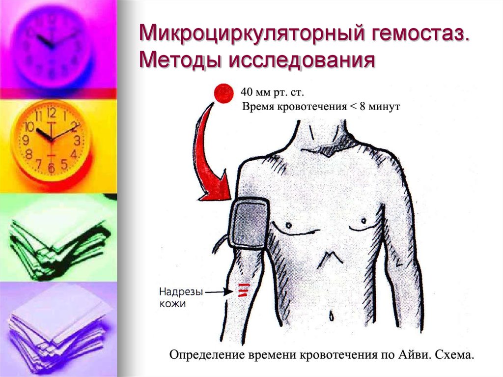 Время кровотечения. Длительность кровотечения по Айви норма. Исследование времени кровотечения. Время кровотечения по Айви методика. Кровотечение по времени.