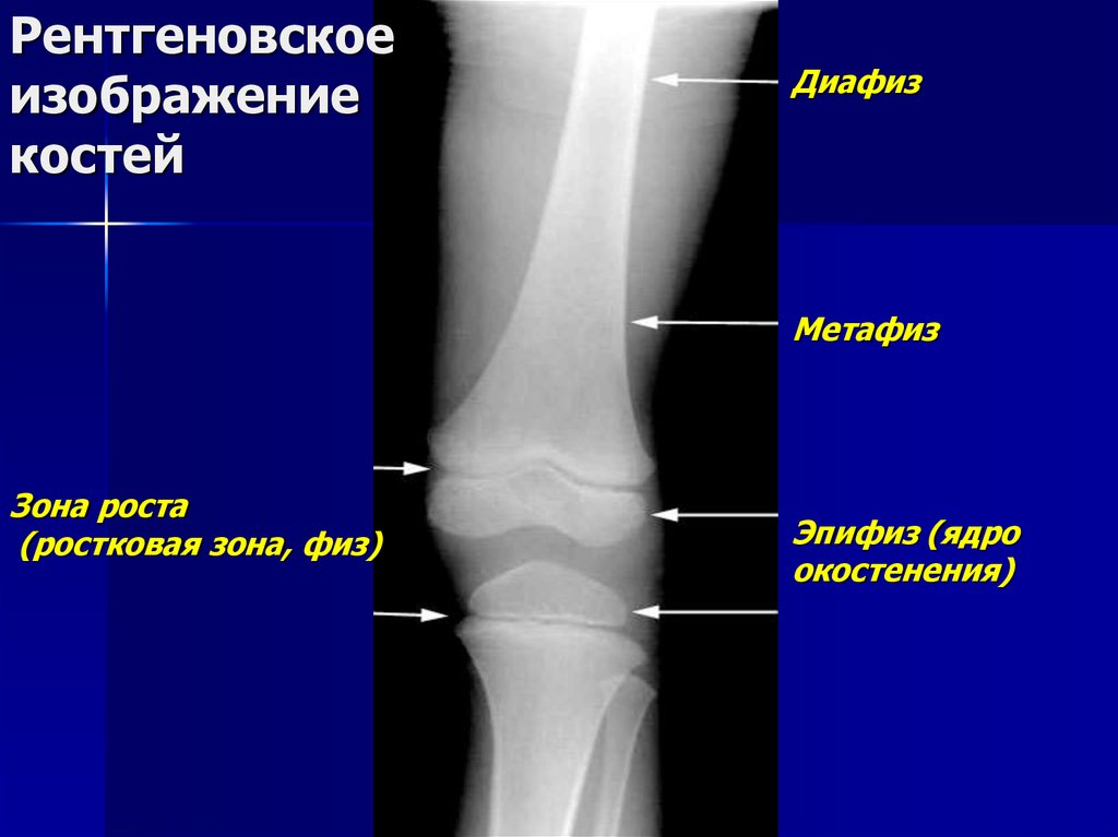 Дистальных метафизов лучевой. Эпифиз метафиз диафиз лучевой кости. Диафиз лучевой кости рентген. Метафиз лучевой кости анатомия.