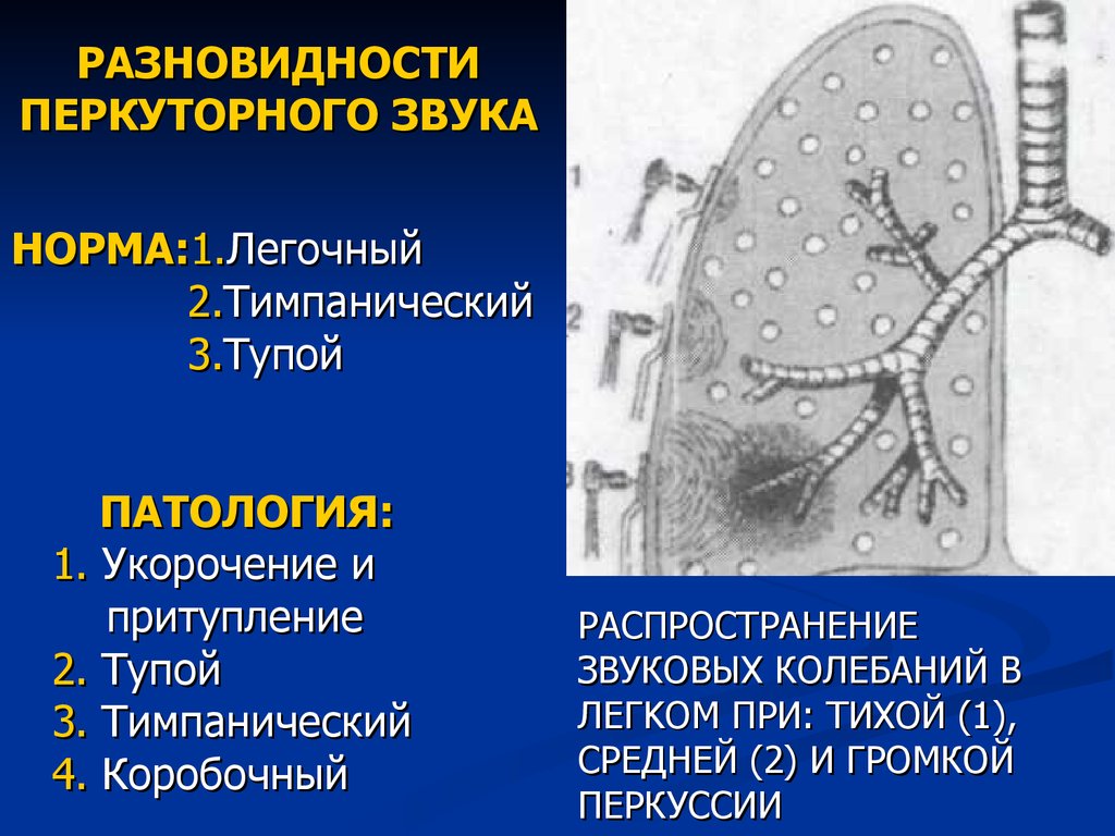 Перкуторный звук в норме