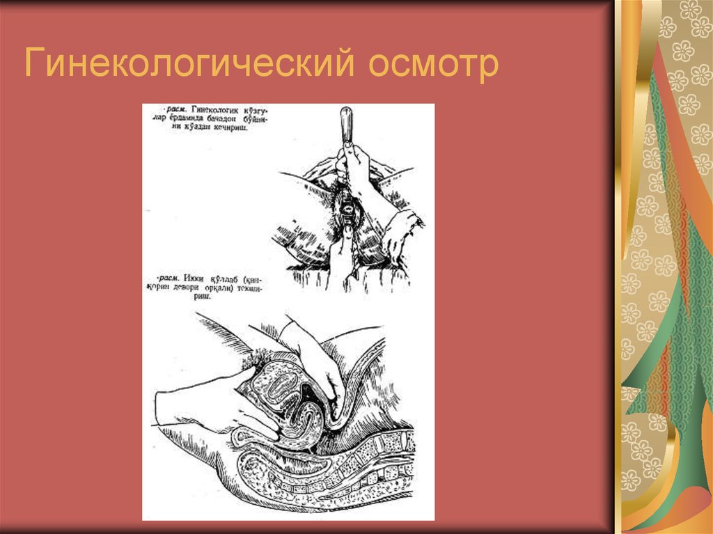 Образец гинекологического осмотра