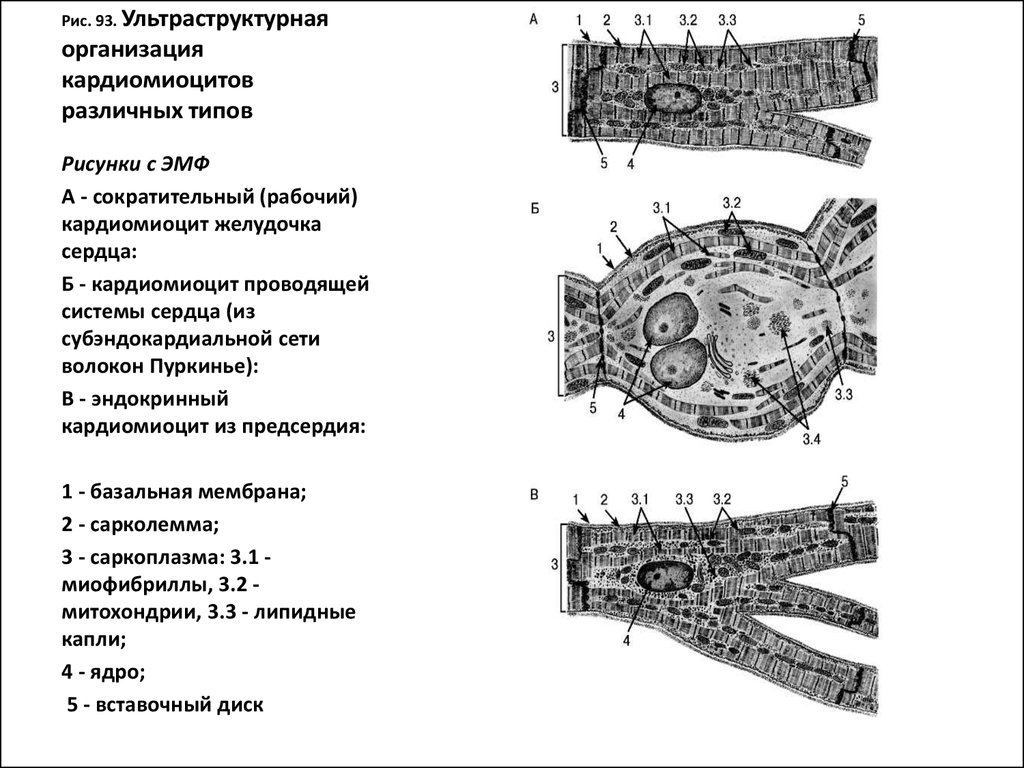 Атипичные кардиомиоциты рисунок