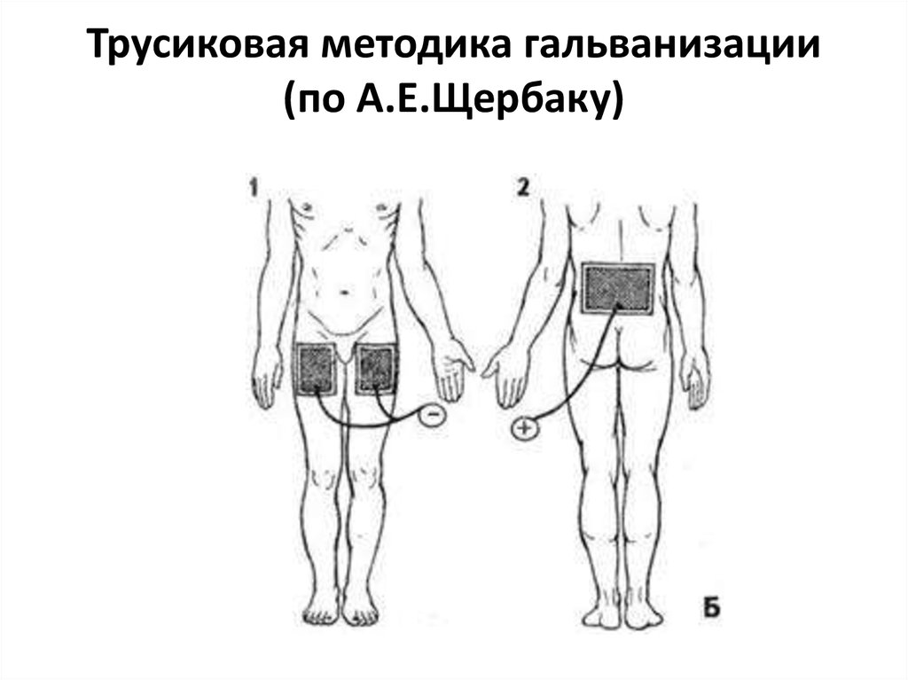 Презентация на тему гальванизация