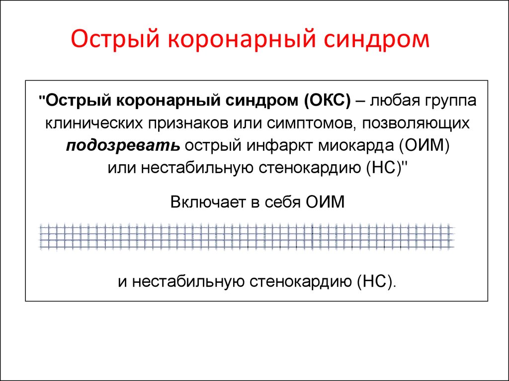 Код окс. Острый коронарный синдром код мкб 10. Острый коронарный синдром по мкб 10. Окс мкб. Классификация острого коронарного синдрома по мкб 10.