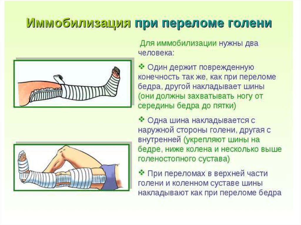 Правила наложения шины презентация