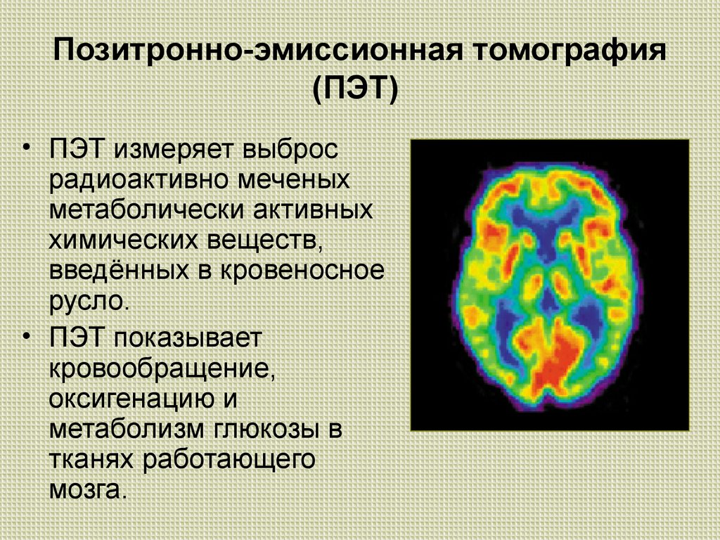 Принципы получения изображения пэт