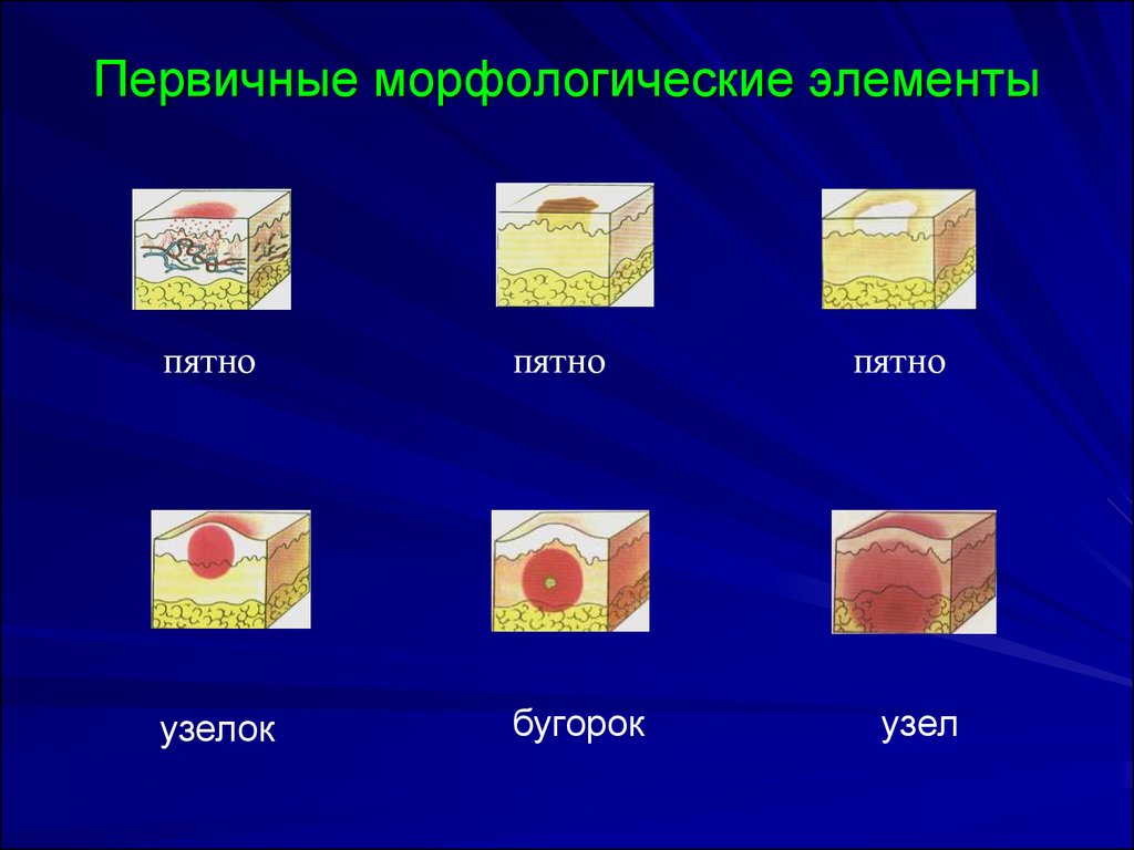 Первичные морфологические элементы кожи презентация - 88 фото