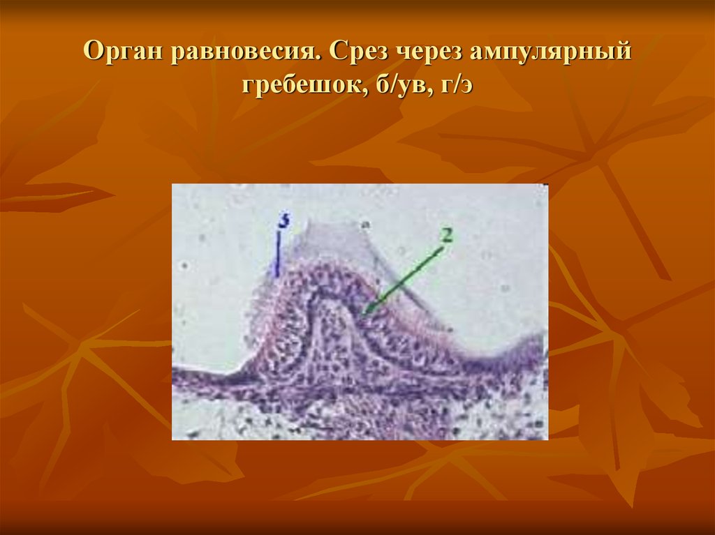 Орган слуха и равновесия презентация гистология