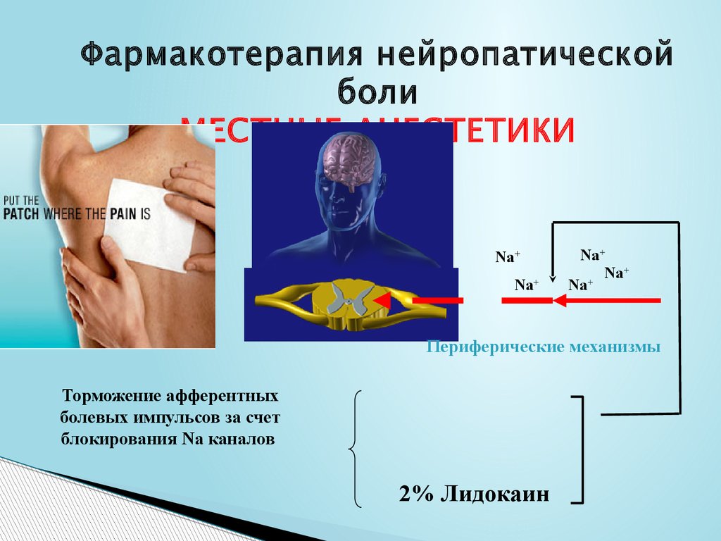 Нейропатическая боль тест нмо