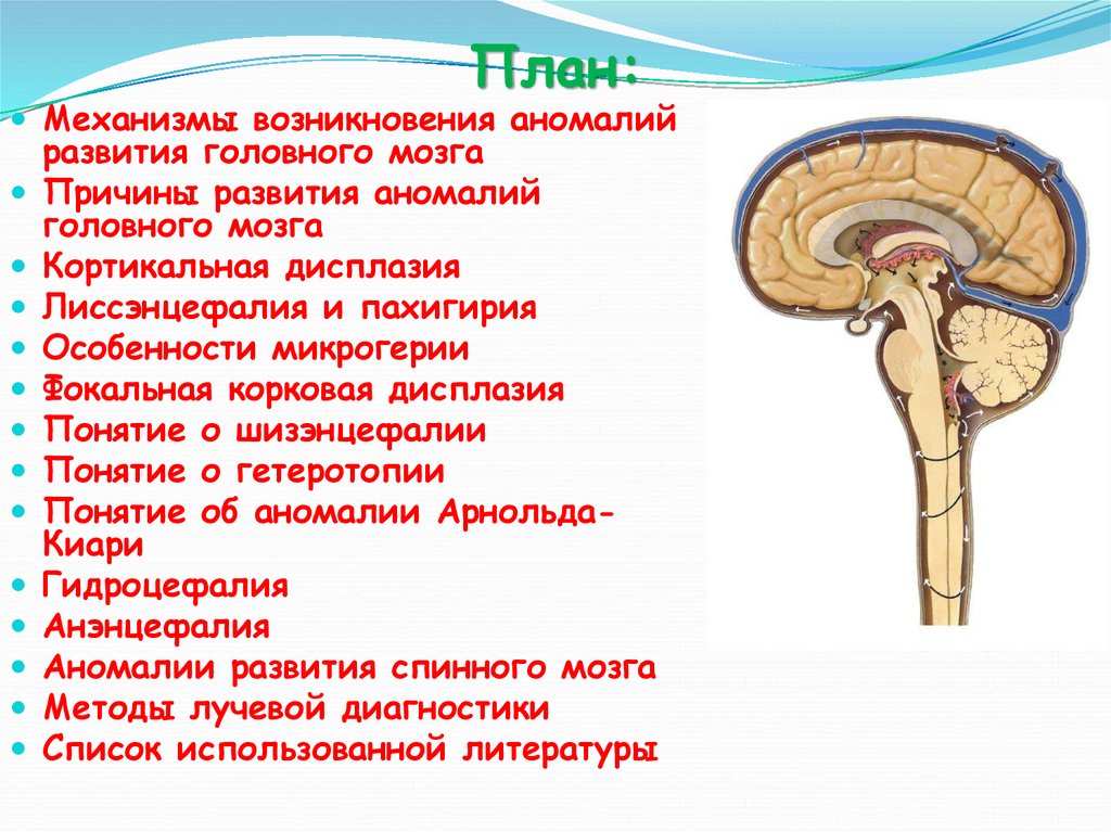 Нарушение развития головного мозга. Аномалии развития мозга. Развитие головного мозга. Аномалии развития головного мозга. Врожденные пороки развития головного мозга.