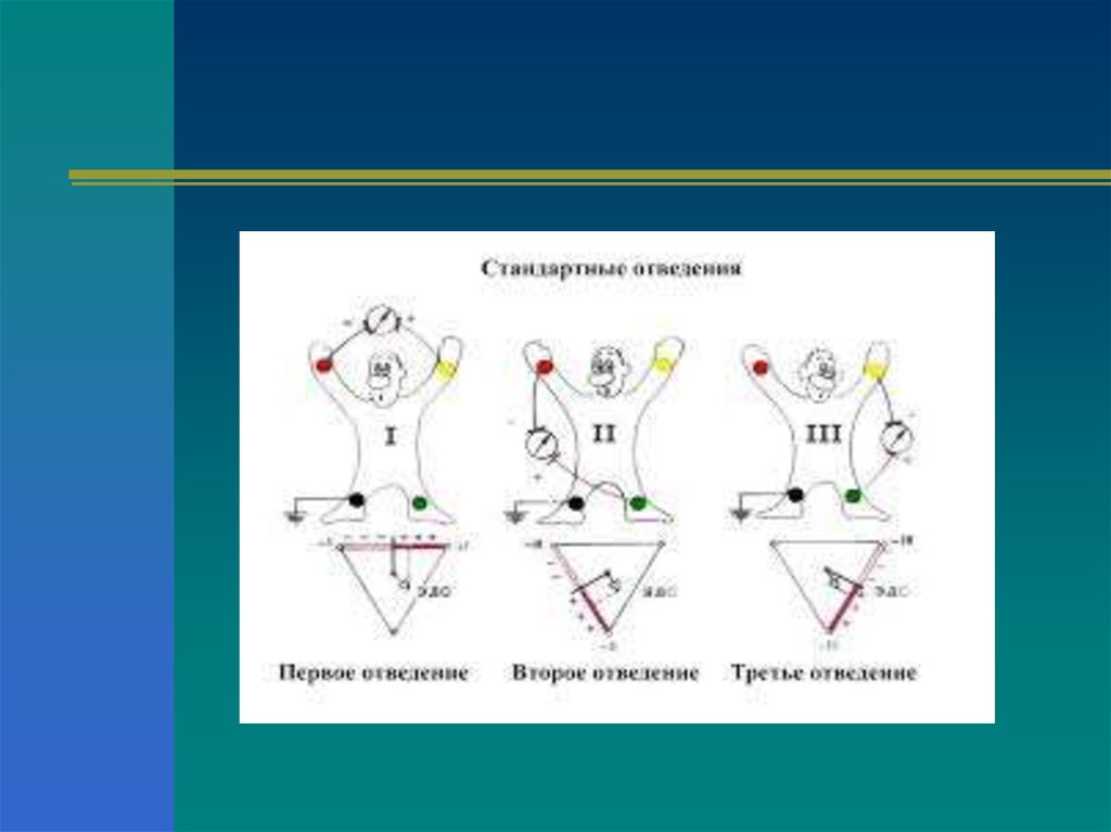 Физические основы электрокардиографии презентация