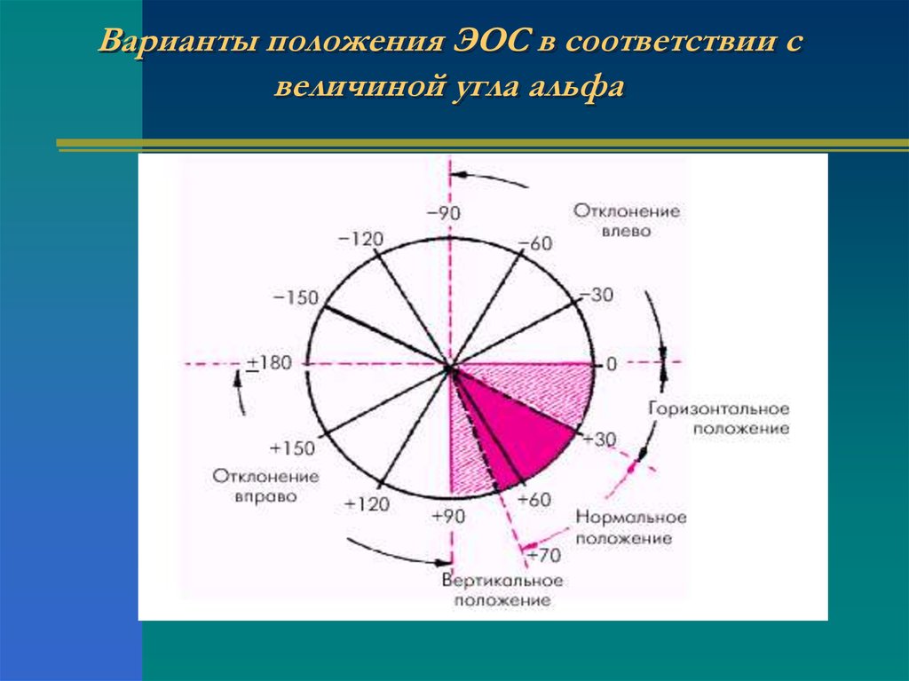 Ось экг. Угол Альфа 110 градусам направление ЭОС. Угол Альфа на ЭКГ 0. При нормальном положении ЭОС угол Альфа:. Электрическая ось сердца на ЭКГ.