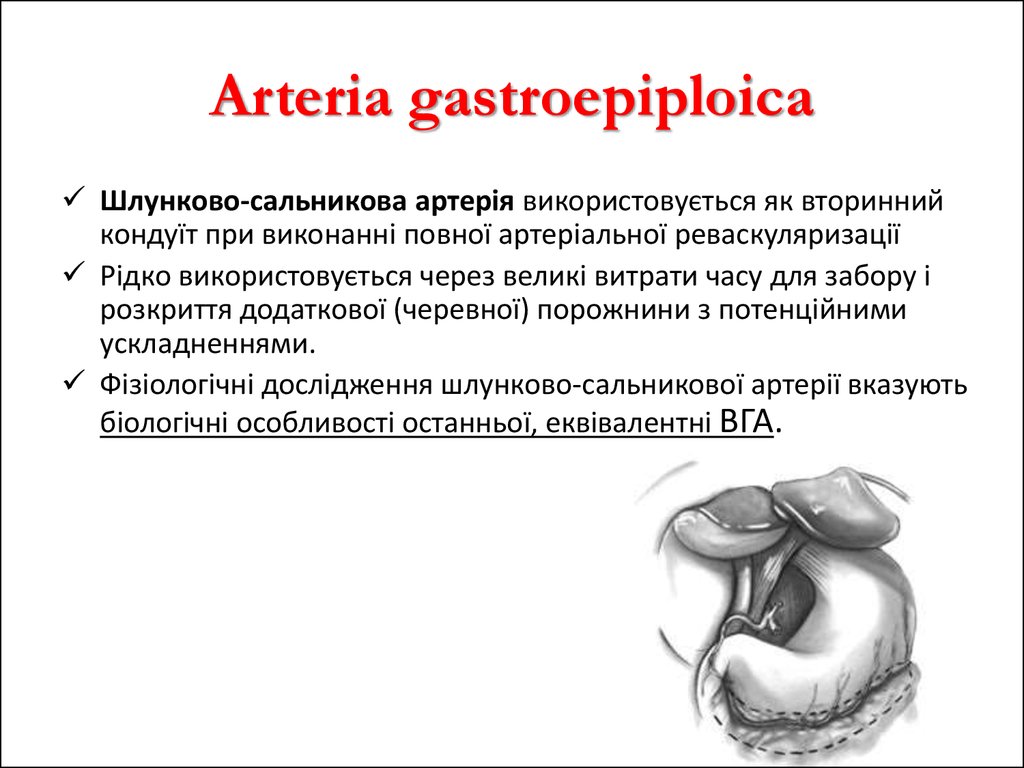 Arteria gastroepiploica