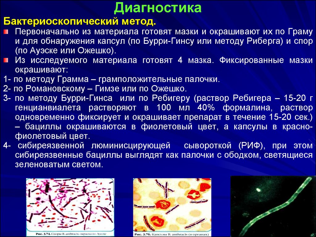 Диагноз сибирская язва. Бактериоскопический метод исследования сибирской язвы. Сибирская язва окраска по Романовскому-Гимза. Эндотоксин сибирской язвы. Окраска по Бурри ГИНСУ методика.