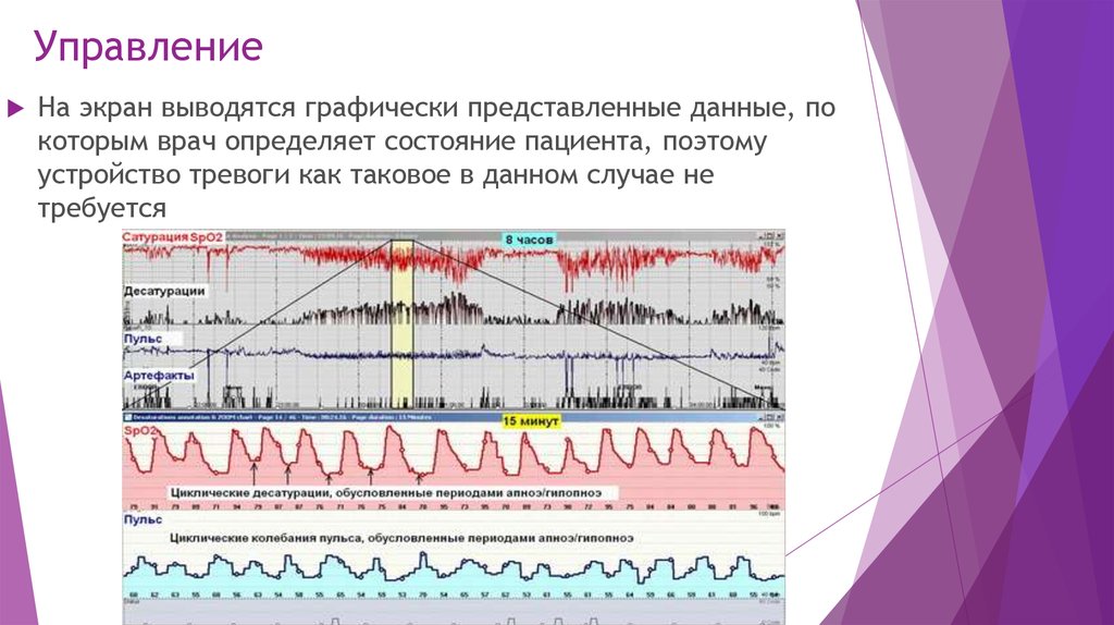 Графически представлен. Представить графически. Как графически представить структуру. Хронология столетия представить графически. Проект как графически представить.