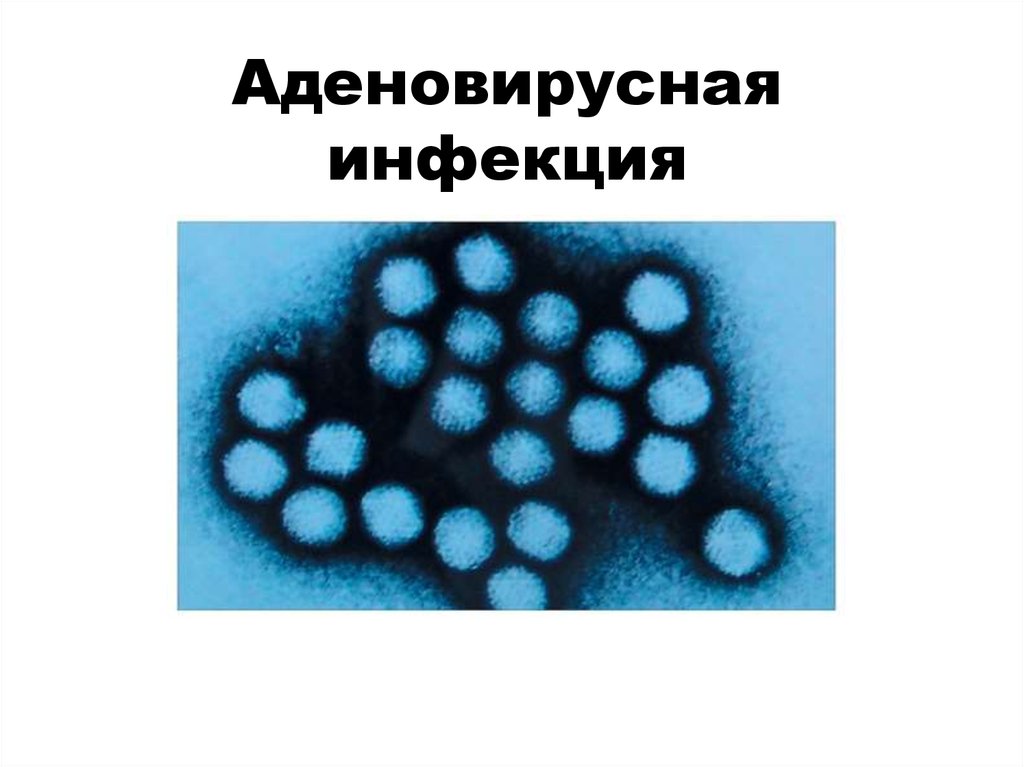 Аденовирус это. Аденовирусная инфекция возбудитель. Коронавирусная инфекция и аденовирусная инфекция. Аденовирусы органотропность. Аденовирусная инфекция клиника.