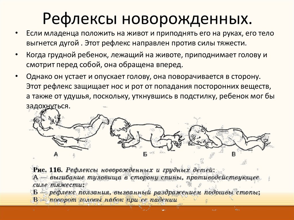 Рефлексы в норме. Безусловные рефлексы новорожденного спинальные. Безусловные рефлексы новорожденного защитный. Защитные рефлексы ребенка грудного возраста. Защитный рефлекс новорожденного.