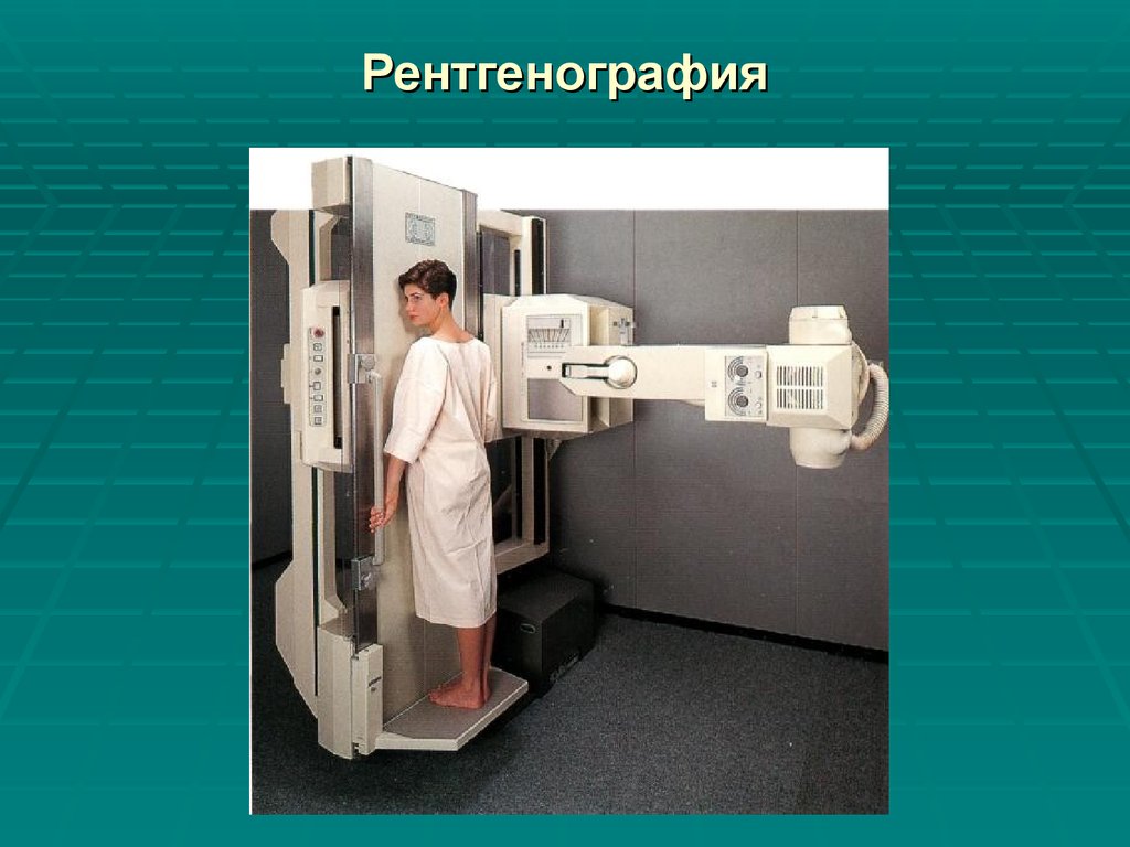 Рентген укладки. Рентгенография. Рентгенография лучевая диагностика. Рентгенография презентация. Защита рентгенолаборанта.