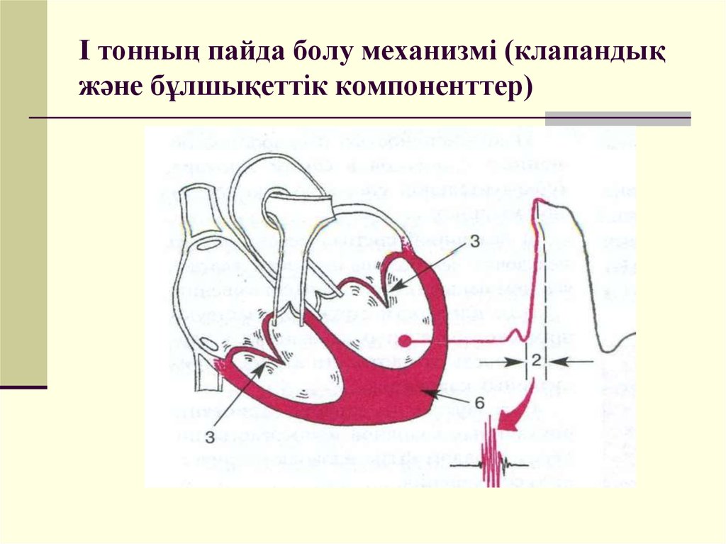 Пайда болу. Веноокклюзивного механизм. Принцип механизма рвентри сердце.