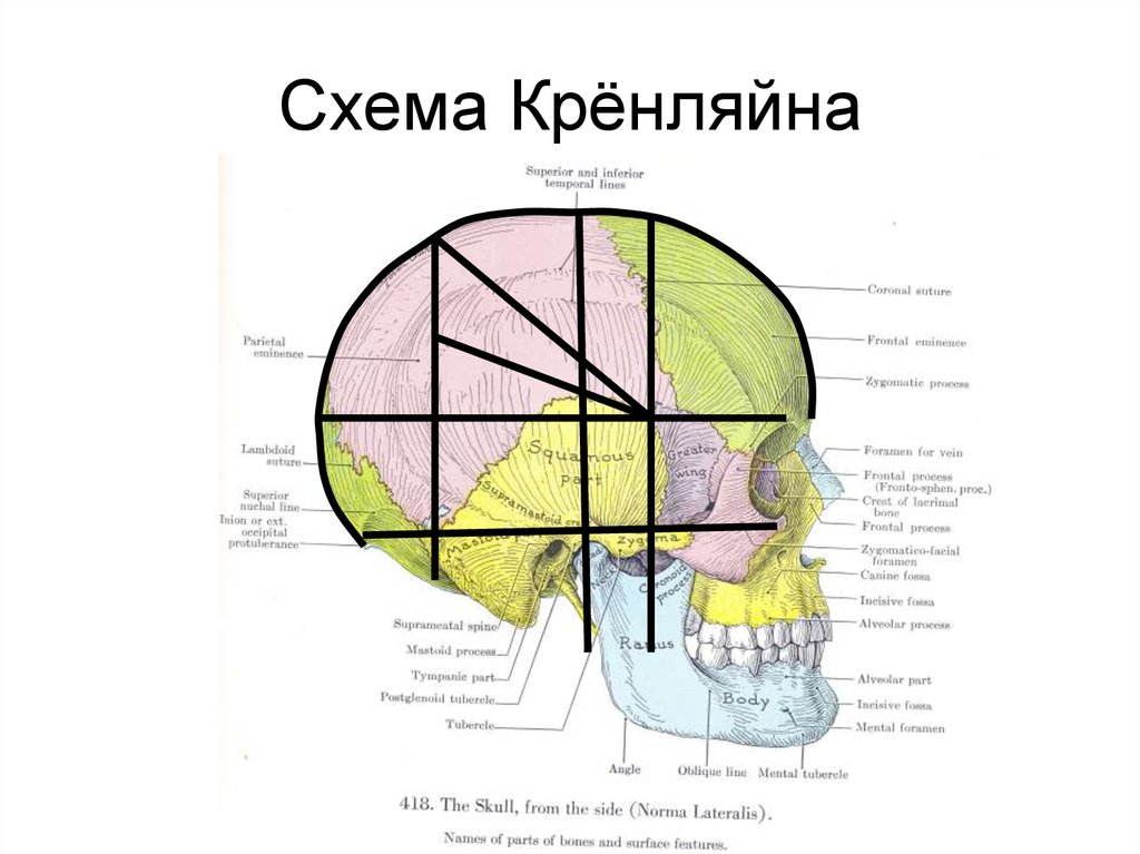 Схема черепно мозговой топографии схема кренлейна