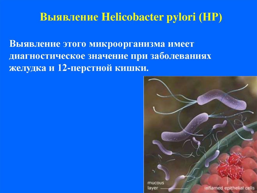 Причины появления хеликобактера. Уреаза Helicobacter pylori. Антигенная структура хеликобактер пилори. Бактерия хеликобактер пилори схема.