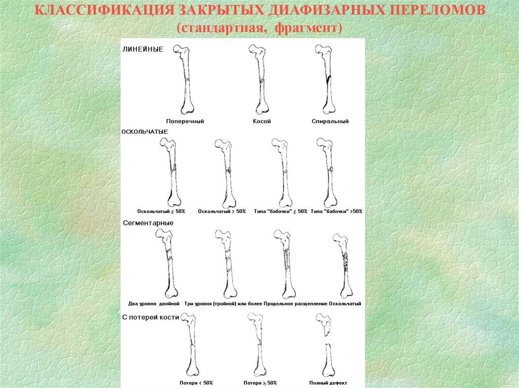 Карта вызова закрытый перелом большеберцовой кости