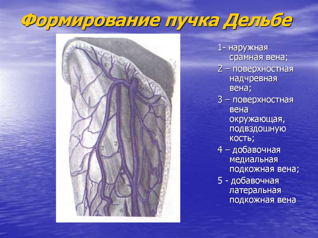 Формирование пучка Дельбе