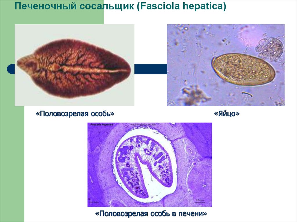 Печеночный сосальщик диагностика. Fasciola hepatica яйца. Марита Fasciola hepatica строение. Марита трематоды. Фасциола гепатика личинка.