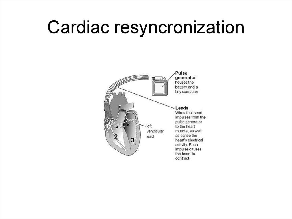 Pacemakers And Implantable Defibrillators Online Presentation