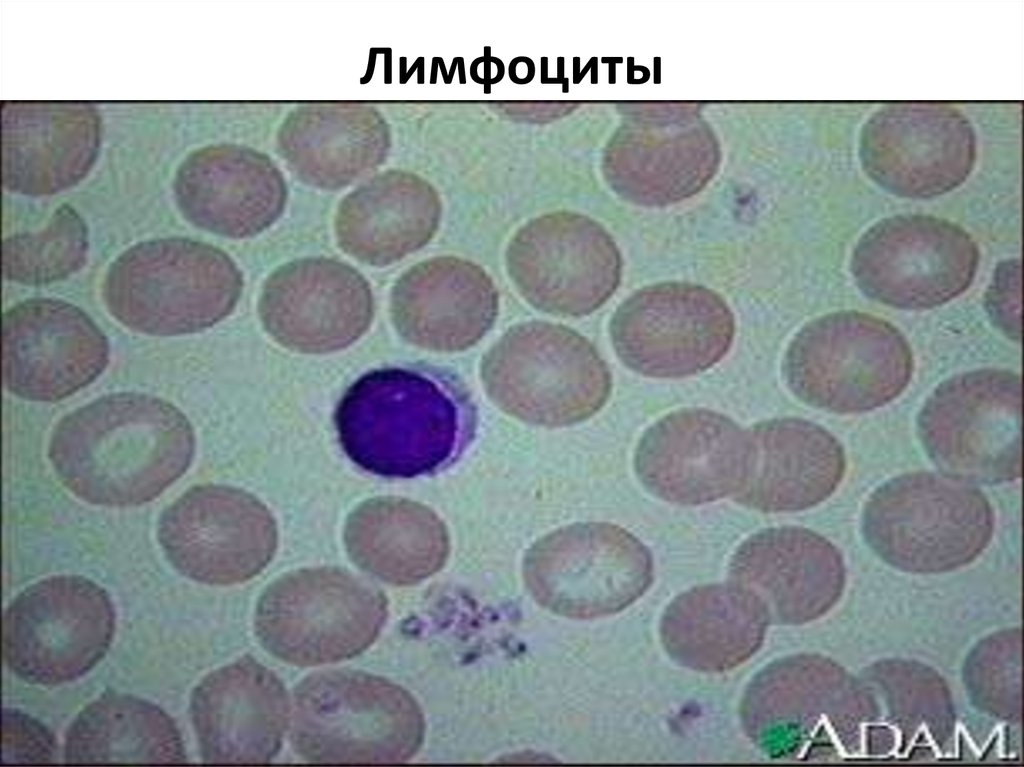 Лимфоциты фото под микроскопом