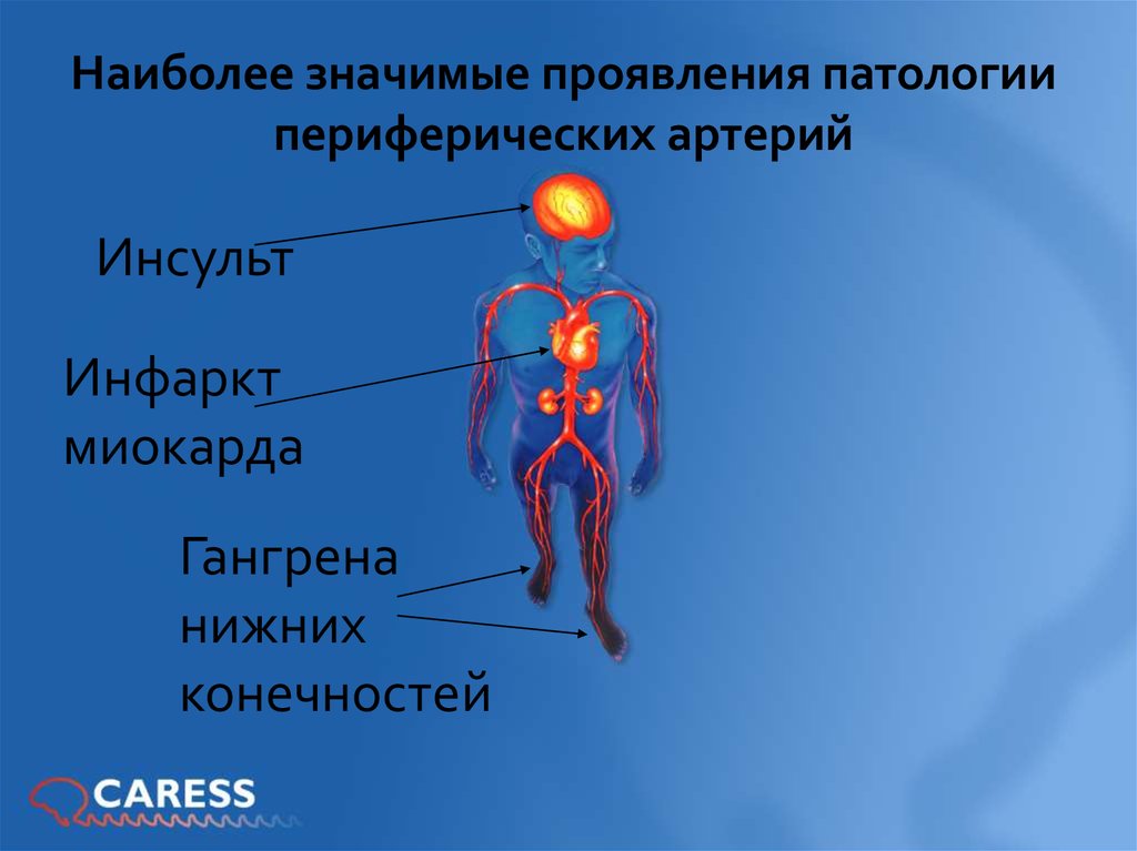 Рожа нижних конечностей фото