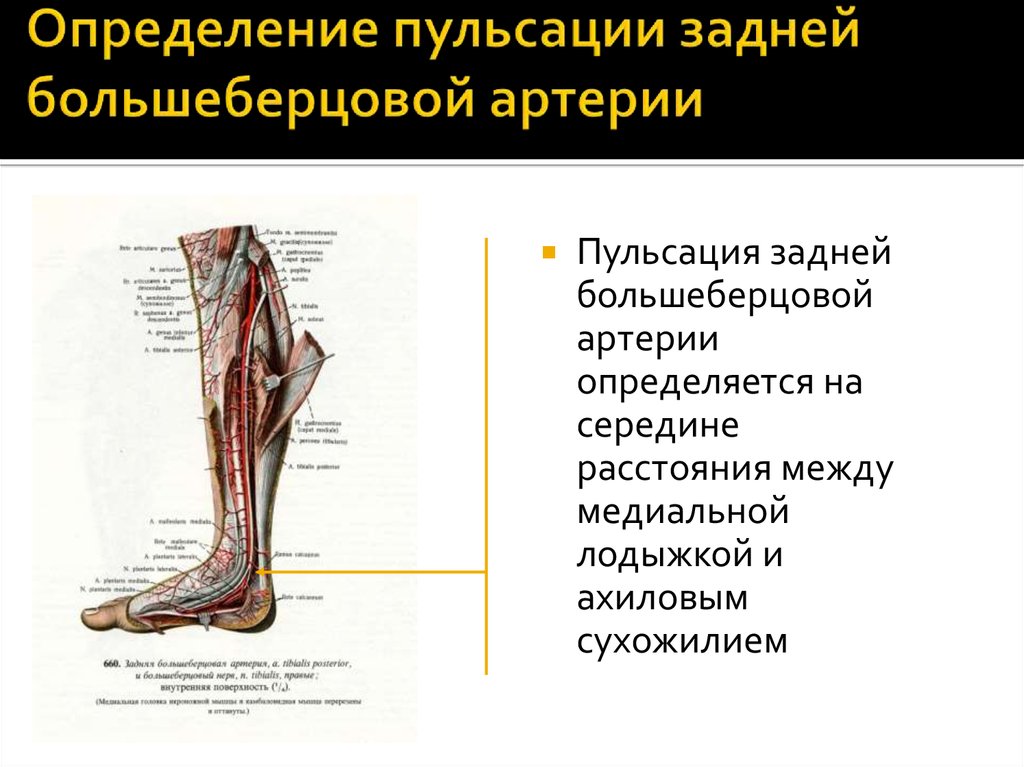 Артерии на стопе пульс. Оценка пульсации артерий нижних конечностей. Методика определения пульсации артерий нижней конечности. Задняя большеберцовая артерия. Пульс на задней большеберцовой артерии определяется.