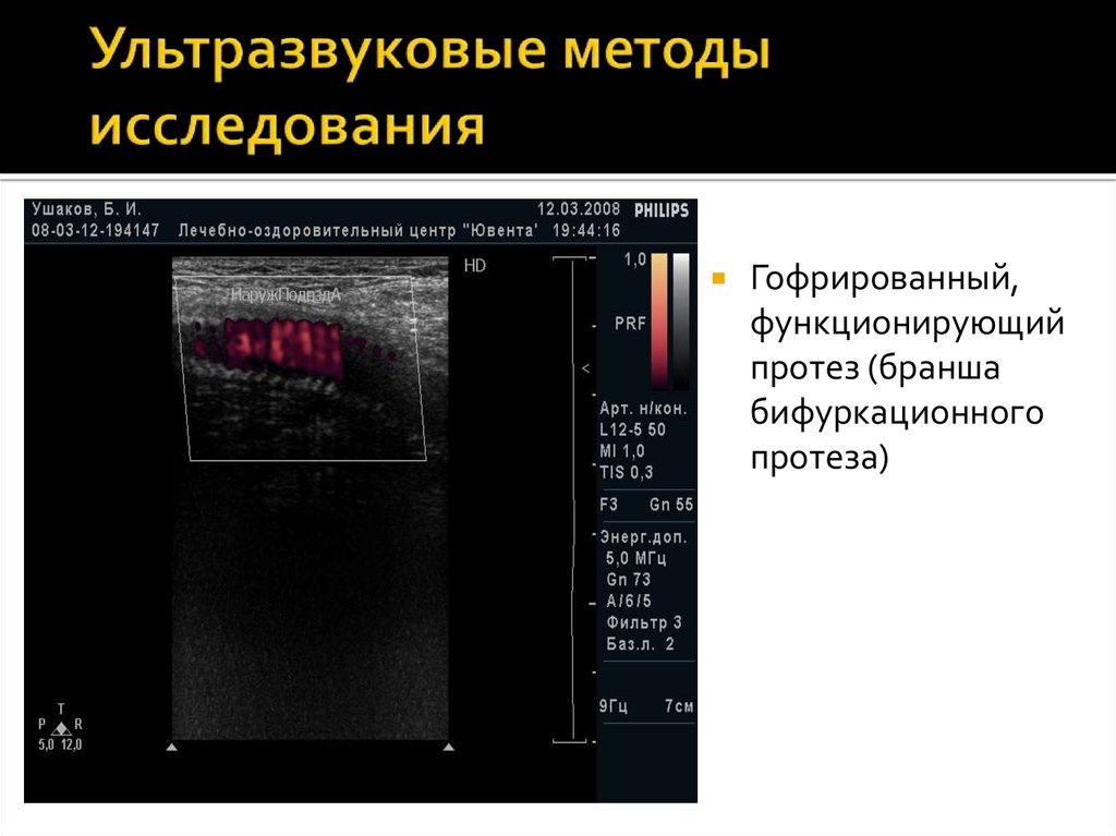 Ультразвуковые методы исследования. Методики ультразвукового исследования. Ультразвуковой метод исследования. Характеристика ультразвукового исследования. Метод исследования ультразвуком.