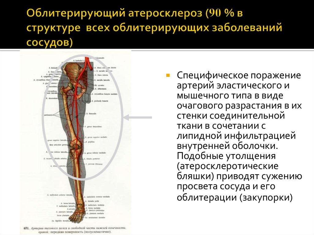 Атеросклеротическое поражение нижних конечностей. Осложнение атеросклероза бедренных артерий. Атеросклероз артерий конечностей осложнения. Осложнения облитерирующего атеросклероза нижних. Облитерирующий атеросклероз нижних конечностей жалобы.
