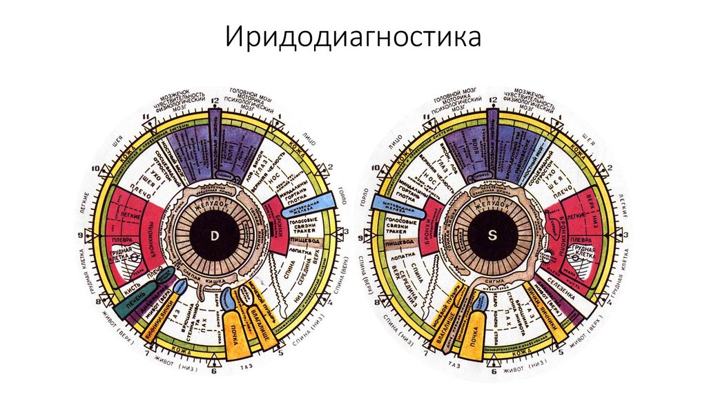 Иридодиагностика фото с расшифровкой