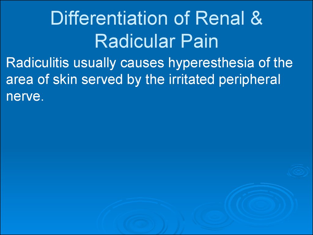 Differentiation of Renal & Radicular Pain