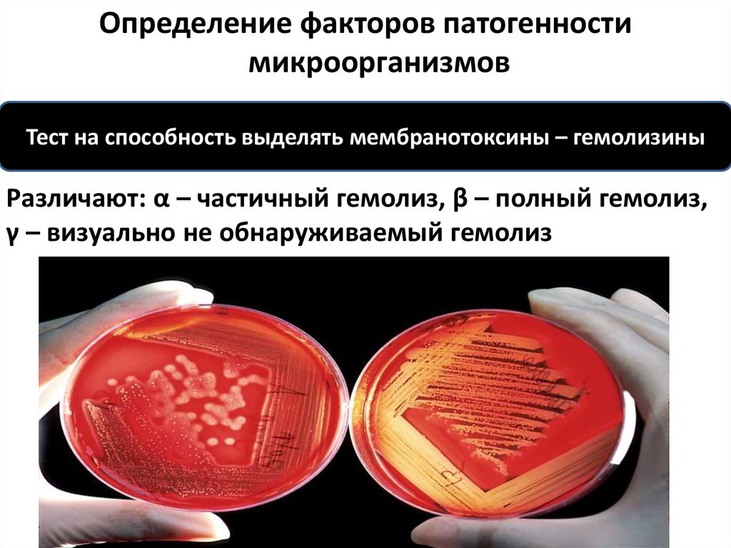 Альфа гемолиз. Определение факторов патогенности. Гемолизин бактерий. Зона гемолиза на кровяном агаре.