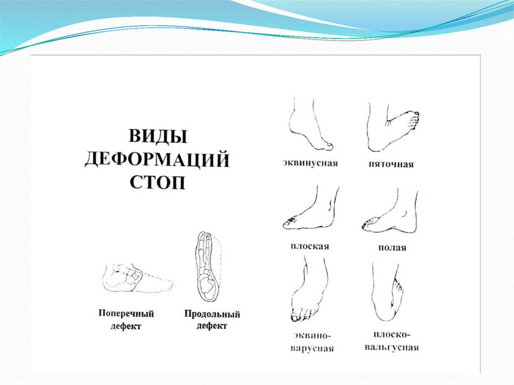 История педикюра презентация