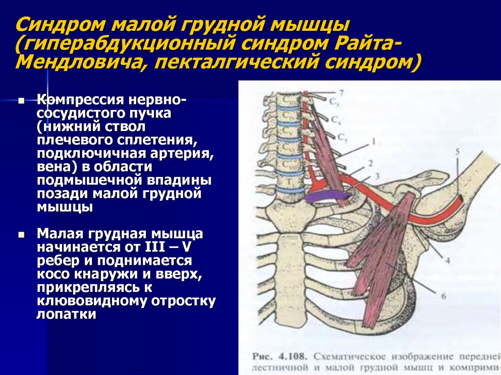 Экстравазальная компрессия артерий